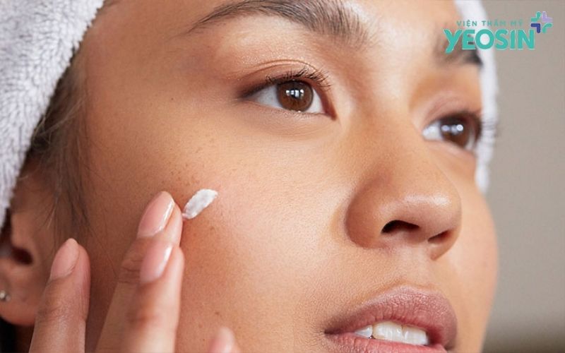 Những lưu ý quan trọng khi sử dụng kem xóa nốt ruồi tại nhà