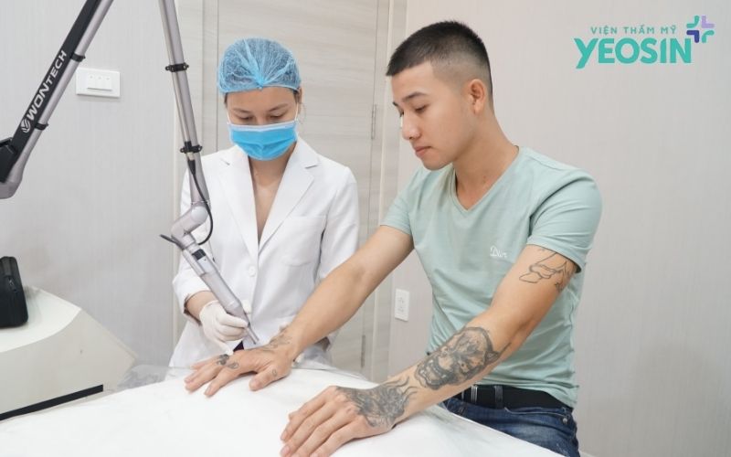 Quy trình xóa xăm bằng laser tại Yeosin diễn ra như thế nào?