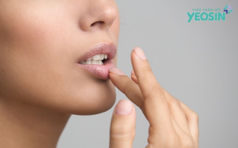 Đốt hạt Fordyce tại Yeosin - Giải pháp cải thiện đốm trắng trên môi bằng công nghệ Plasma 13 Chăm Sóc Sau Khi Đốt Hạt Fordyce