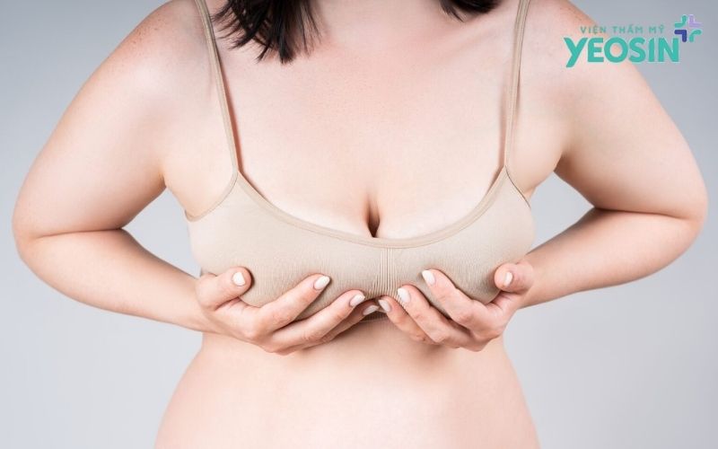 Nâng Ngực Treo Sa Trễ: Giải Pháp Lấy Lại Vòng 1 Săn Chắc, Tự Nhiên