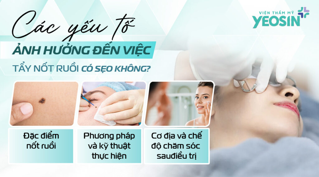 Góc giải đáp: Tẩy nốt ruồi có đau không, có sẹo không? 9 Các yếu tố ảnh hưởng đến việc tẩy nốt ruồi có sẹo không