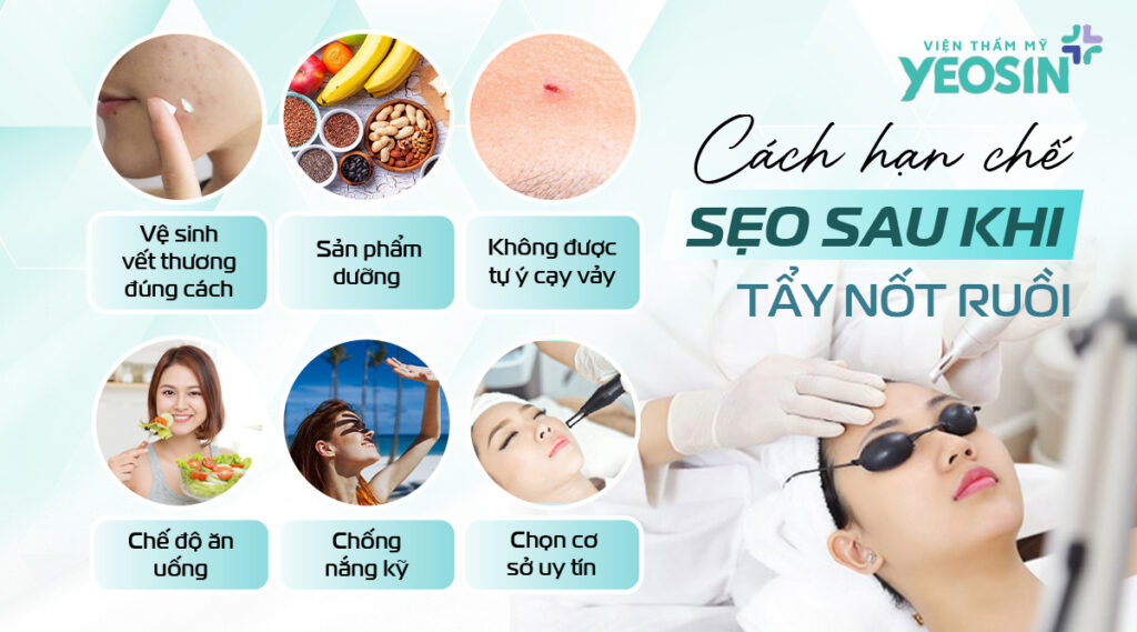 Góc giải đáp: Tẩy nốt ruồi có đau không, có sẹo không? 10 Cách hạn chế sẹo sau khi tẩy nốt ruồi