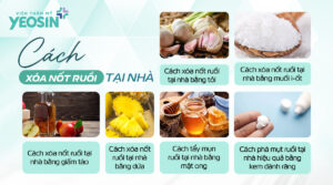 cách xóa nốt ruồi tại nhà hiệu quả