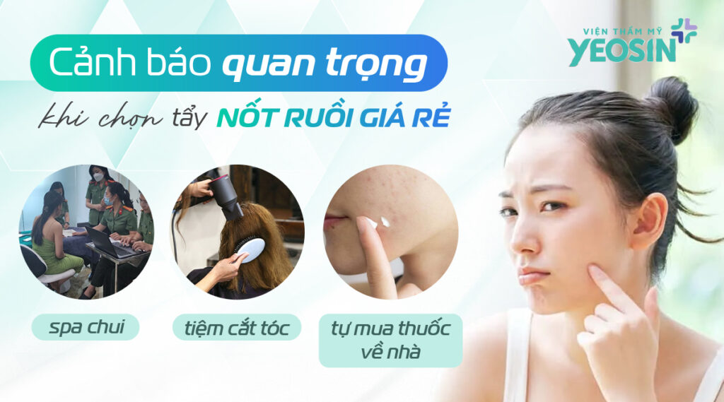 Cảnh báo quan trọng khi chọn tẩy nốt ruồi giá rẻ
