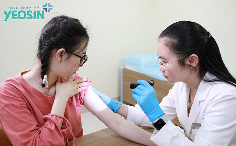 Dấu hiệu bất thường cần thăm khám bác sĩ sau tẩy nốt ruồi