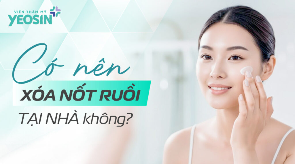 Có nên xóa nốt ruồi tại nhà không?