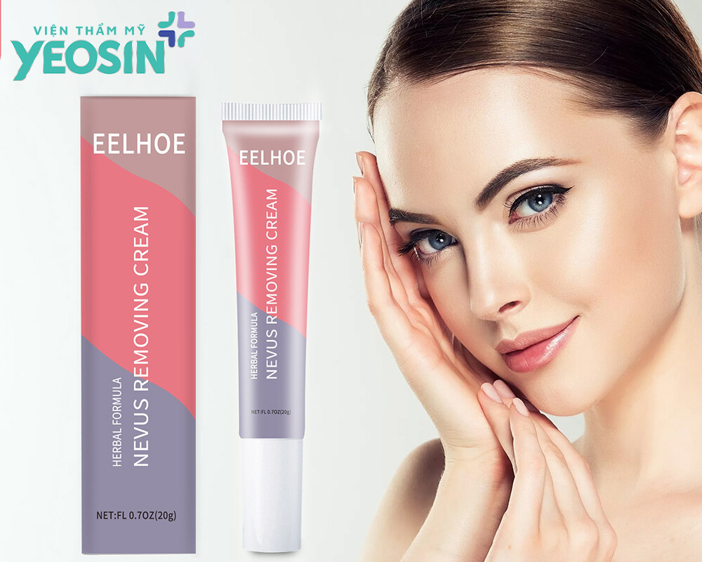 Kem tẩy nốt ruồi của Hàn Eelhoe