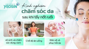 Kinh nghiệm chăm sóc da sau khi tẩy nốt ruồi