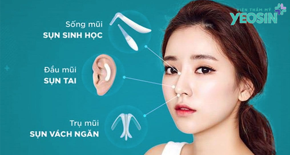 Nâng mũi cấu trúc là gì