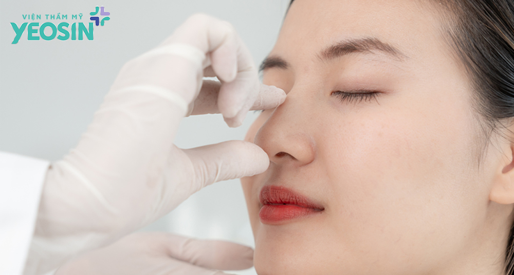 Ưu nhược điểm của nâng mũi cấu trúc và bán cấu trúc