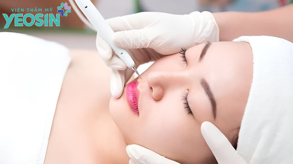 Có nên tẩy nốt ruồi trên môi không?