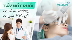 Tẩy nốt ruồi có đau không, có sẹo không?