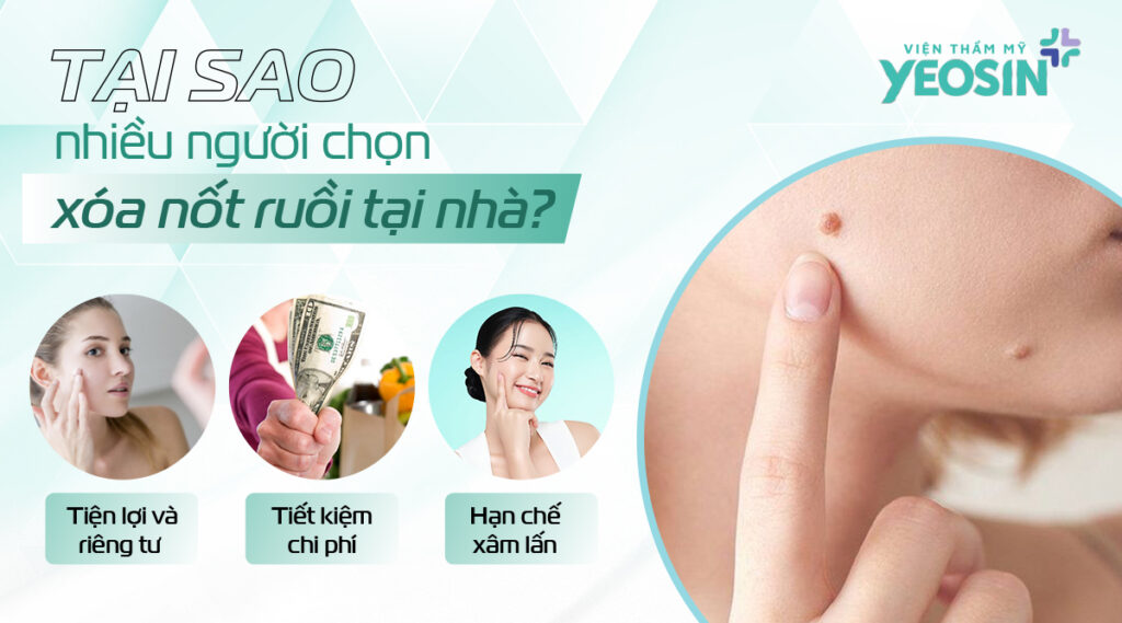 Tại sao nhiều người chọn xóa nốt ruồi tại nhà?
