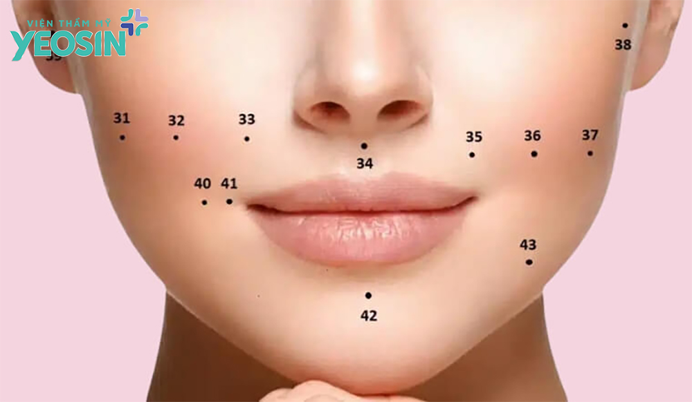 Có nên xóa nốt ruồi trên mặt không?