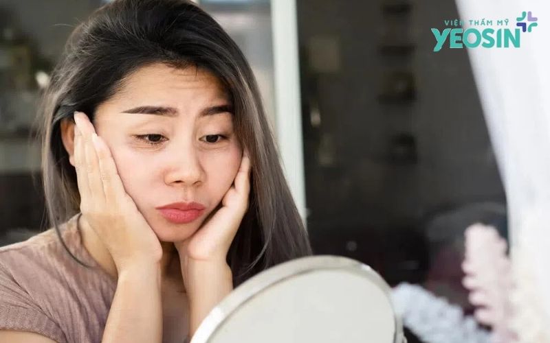 Bí Quyết Trị Quầng Thâm Mắt Dứt Điểm Và An Toàn