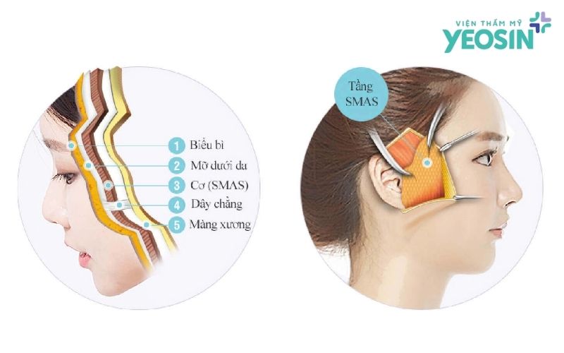 Lớp SMAS Là Gì?