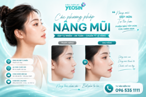 Các phương pháp nâng mũi phổ biến nhất 2026