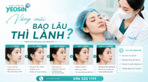 Nâng mũi bao lâu thì lành?