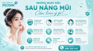 Những ngày đầu sau nâng mũi cần lưu ý gì?