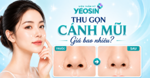 Thu gọn cánh mũi giá bao nhiêu - Bảng giá thu nhỏ cánh mũi