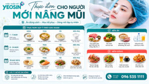 Thực đơn cho người mới nâng mũi trong 7 ngày đầu tiên