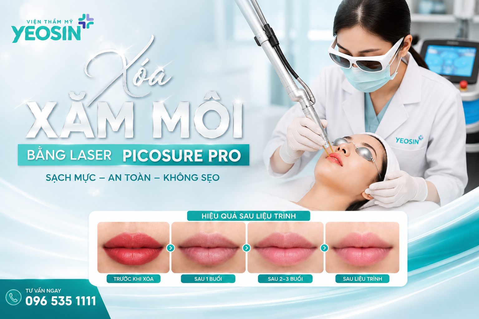 Xóa xăm môi bằng laser