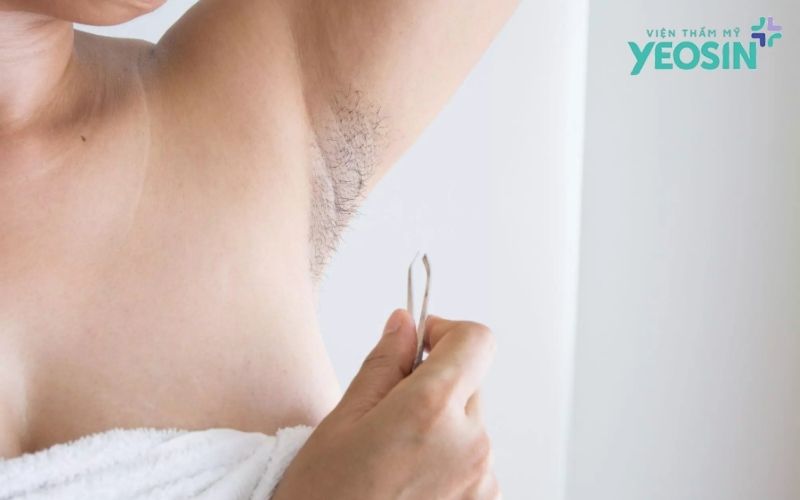 Trị Thâm Nách Hiệu Quả: Nguyên Nhân, Cách Khắc Phục 10 Nguyên nhân nách bị thâm sạm