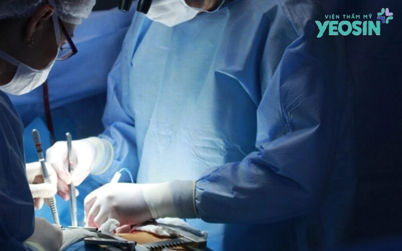 Kỹ thuật "bóc tách kép" chuyên sâu của Công nghệ căng da mặt SMAS tại Yeosin