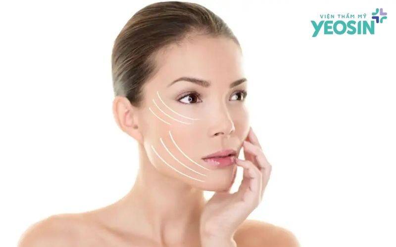 Căng da mặt SMAS khác gì so với các phương pháp trẻ hóa khác?