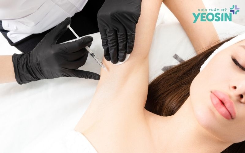 Loại bỏ tuyến mồ hôi nách: Giải pháp hỗ trợ giảm mồ hôi và hôi nách 13 Các phương pháp điều trị mồ hôi nách