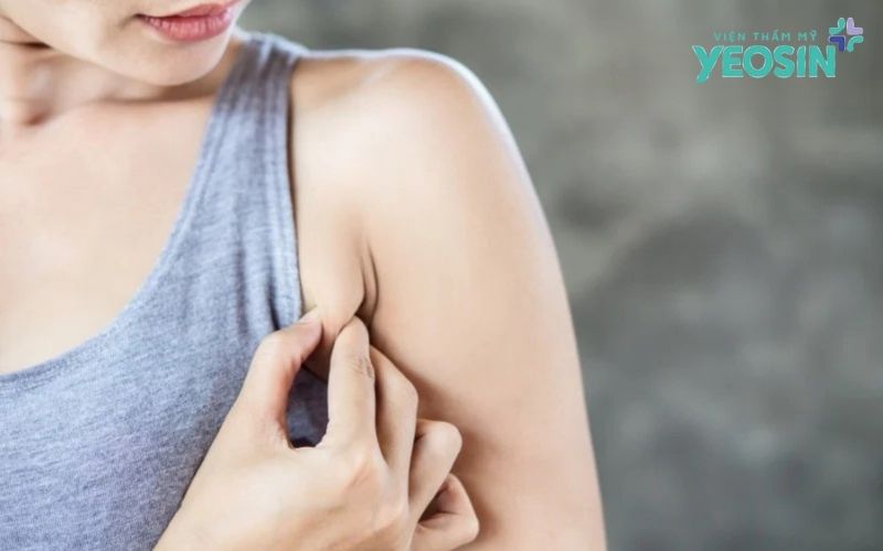 Trị Thâm Nách Hiệu Quả: Nguyên Nhân, Cách Khắc Phục 11 Thâm Nách Có Nguy Hiểm Không?