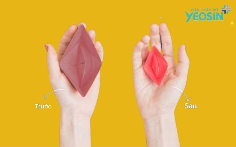 Thu nhỏ cô bé là gì? Những điều cần biết