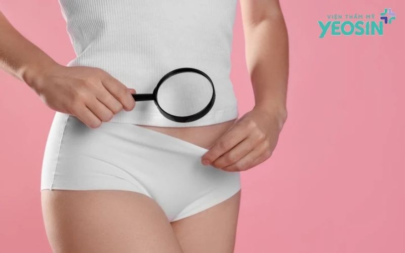 Làm hồng cô bé cho mẹ sau sinh an toàn, hiệu quả 6 Tại sao vùng kín của mẹ sau sinh lại bị thâm sạm nặng nề?