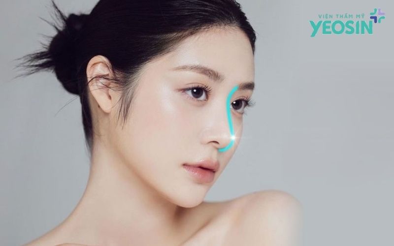 anh Yeosin 7 1