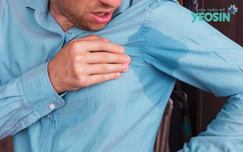 Loại bỏ tuyến mồ hôi nách: Giải pháp hỗ trợ giảm mồ hôi và hôi nách 10 Mồ Hôi Nách Là Gì?