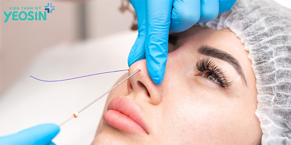 Gợi ý các phương pháp nâng mũi không cần phẫu thuật.