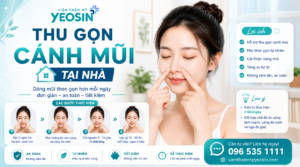 Top 5 cách làm thu nhỏ cánh mũi tại nhà đơn giản