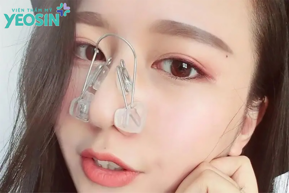 Sử dụng kẹp mũi giúp thu nhỏ cánh mũi tại nhà