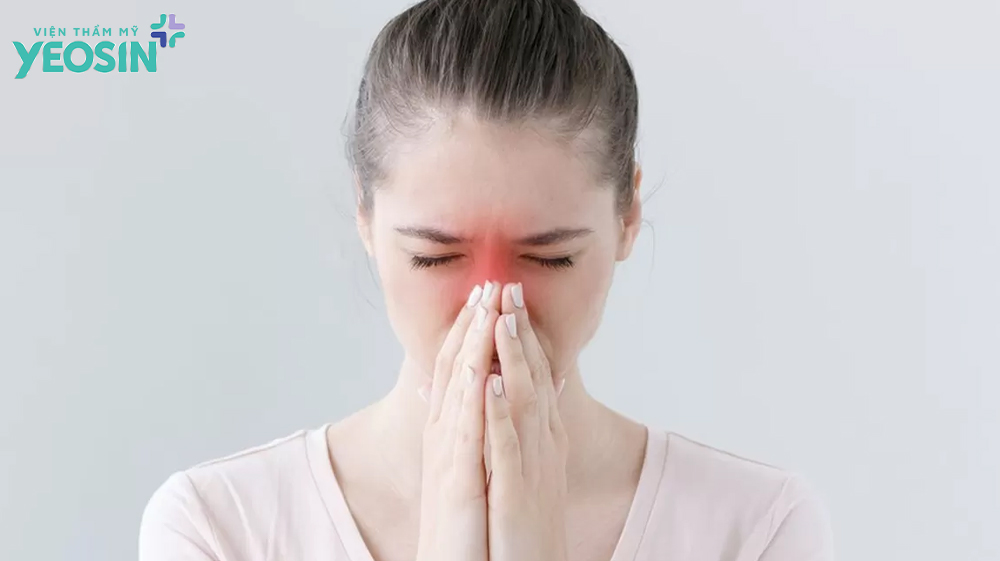 Có nên nâng mũi không? Những điều cần lưu ý 14 Người bị viêm xoang có nên nâng mũi không?