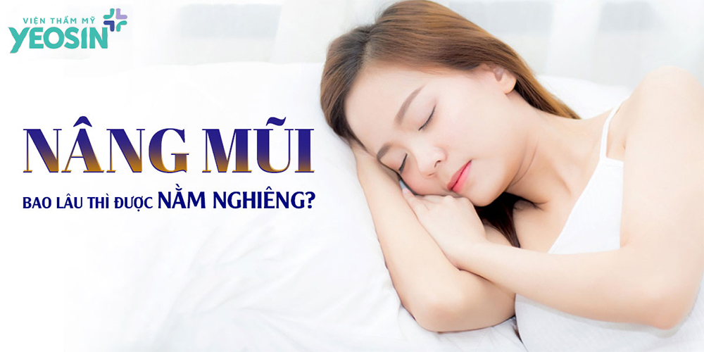 Nâng mũi bao lâu được nằm nghiêng?