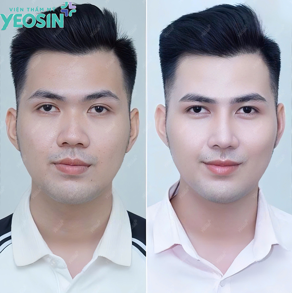 nang mui cho nam gioi yeosin 3 1