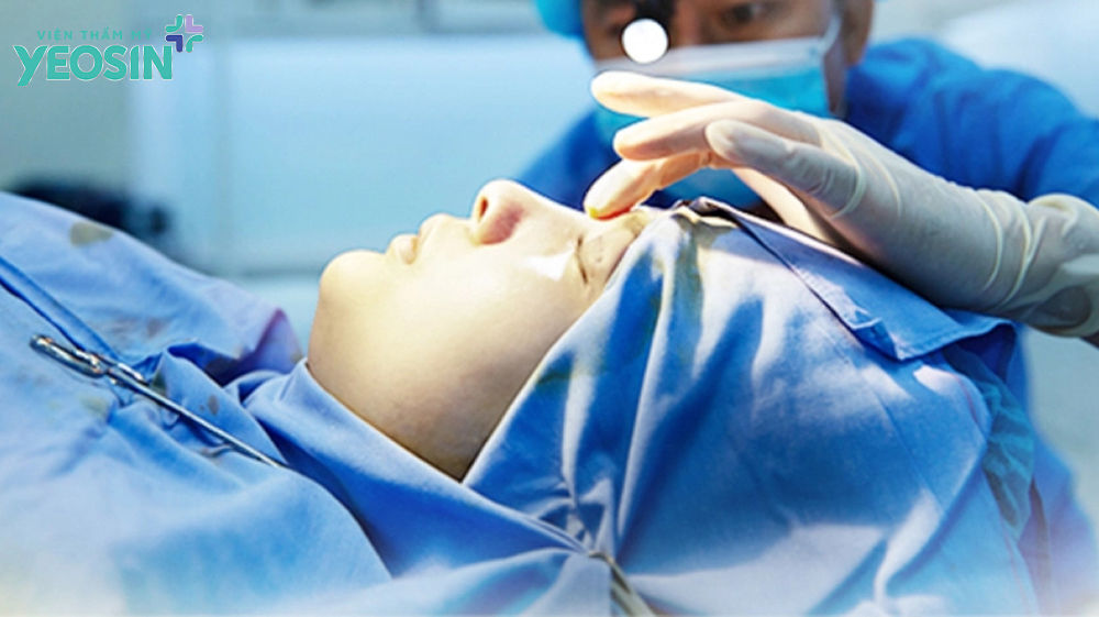 Nâng mũi cho nam giới đẹp tự nhiên và những lưu ý quan trọng 9 Các phương pháp nâng mũi cho nam giới phổ biến nhất