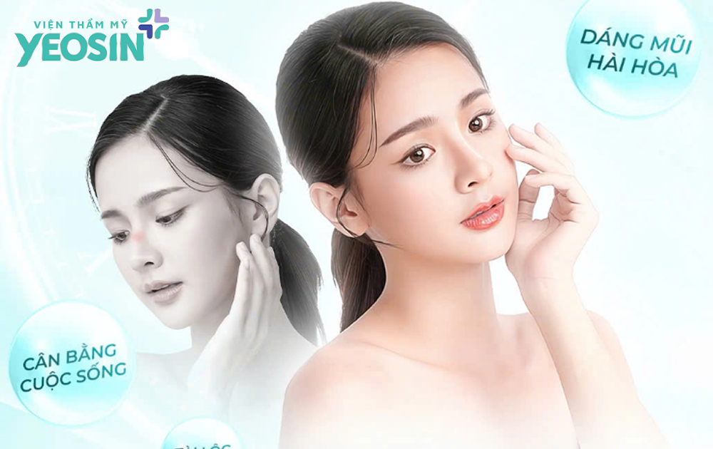 Có nên nâng mũi phong thủy không?