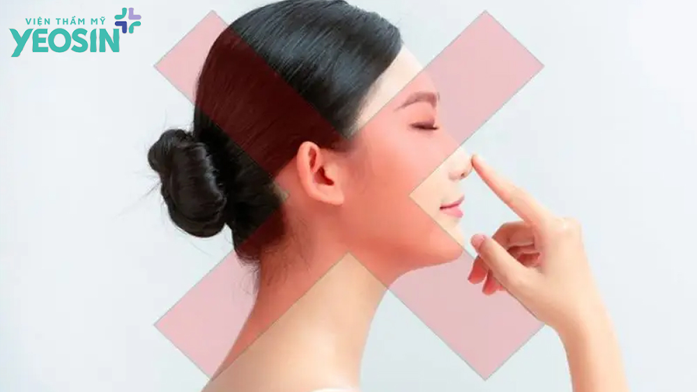 Người dưới 18 tuổi nên cân nhắc khi phẫu thuật nâng mũi