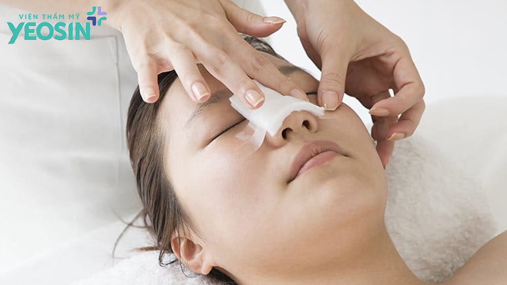 Những lưu ý sau khi nâng mũi để vết thương nhanh hồi phục