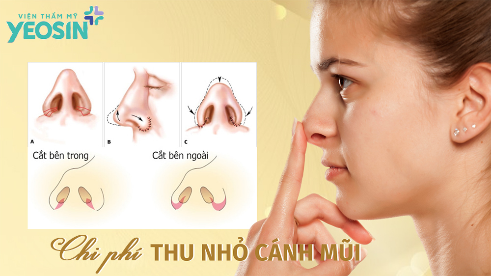 Thu gọn cánh mũi giá bao nhiêu là hợp lý?