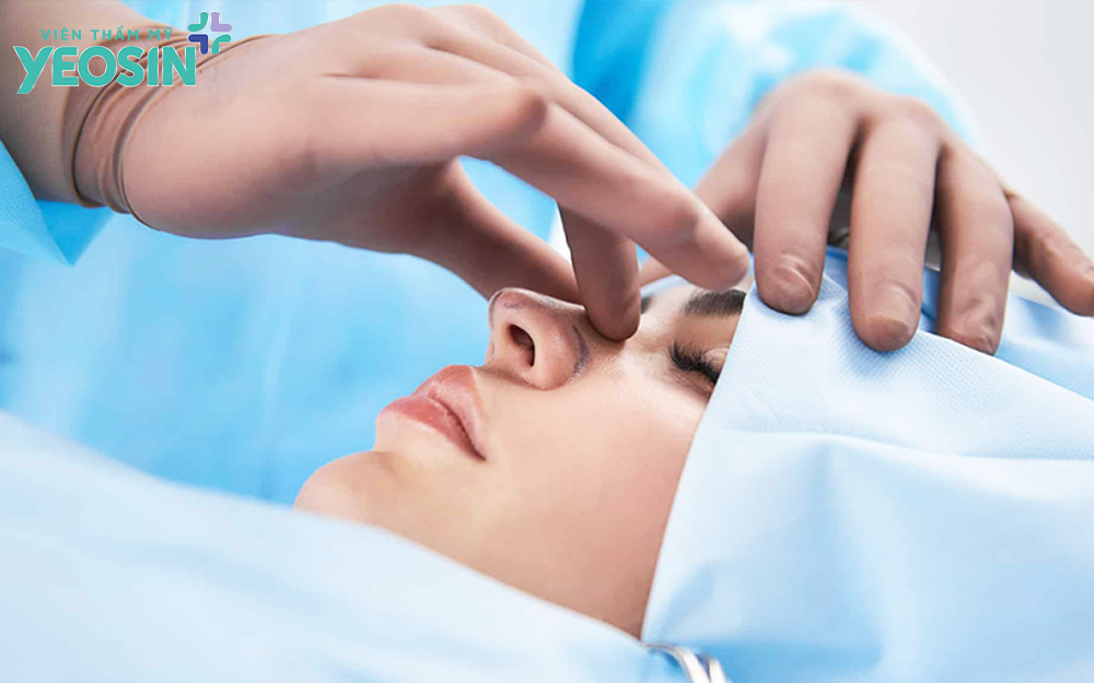 Tuổi thọ của nâng mũi phụ thuộc vào tay nghề và kỹ thuật của bác sĩ