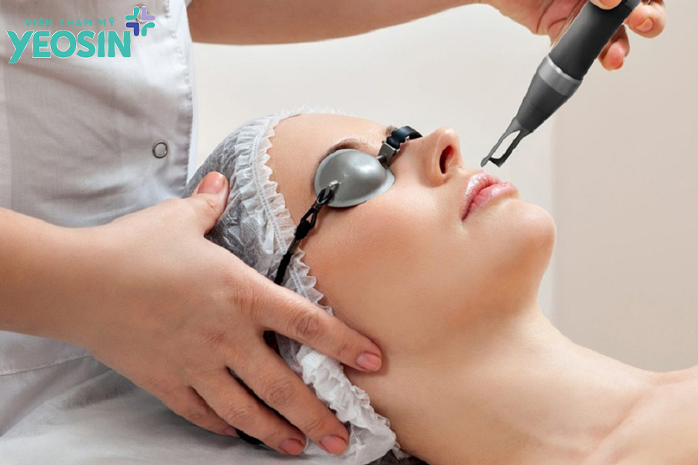 Xóa xăm môi bằng công nghệ Laser hiện đại