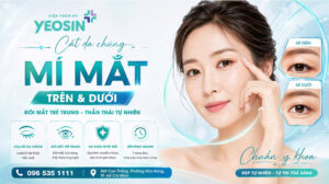 Cắt da chùng mí mắt trên dưới - Xóa bỏ dấu hiệu lão hóa