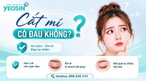 Cắt mí có đau không? Cách chăm sóc da sau khi cắt mí mắt